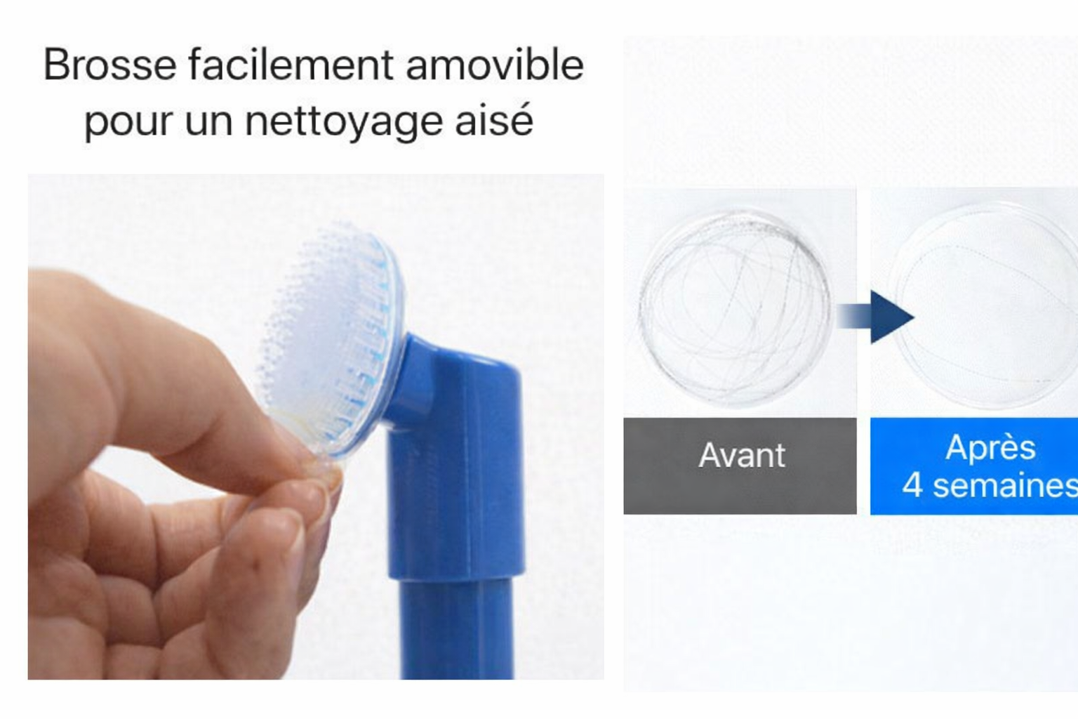 Scalpy Duo – Soin Capillaire Anti-Chute & Activation de la Repousse