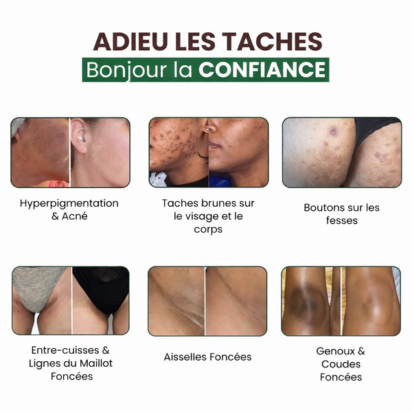 Savon BOWVIBE Anti-taches Curcuma Puissant