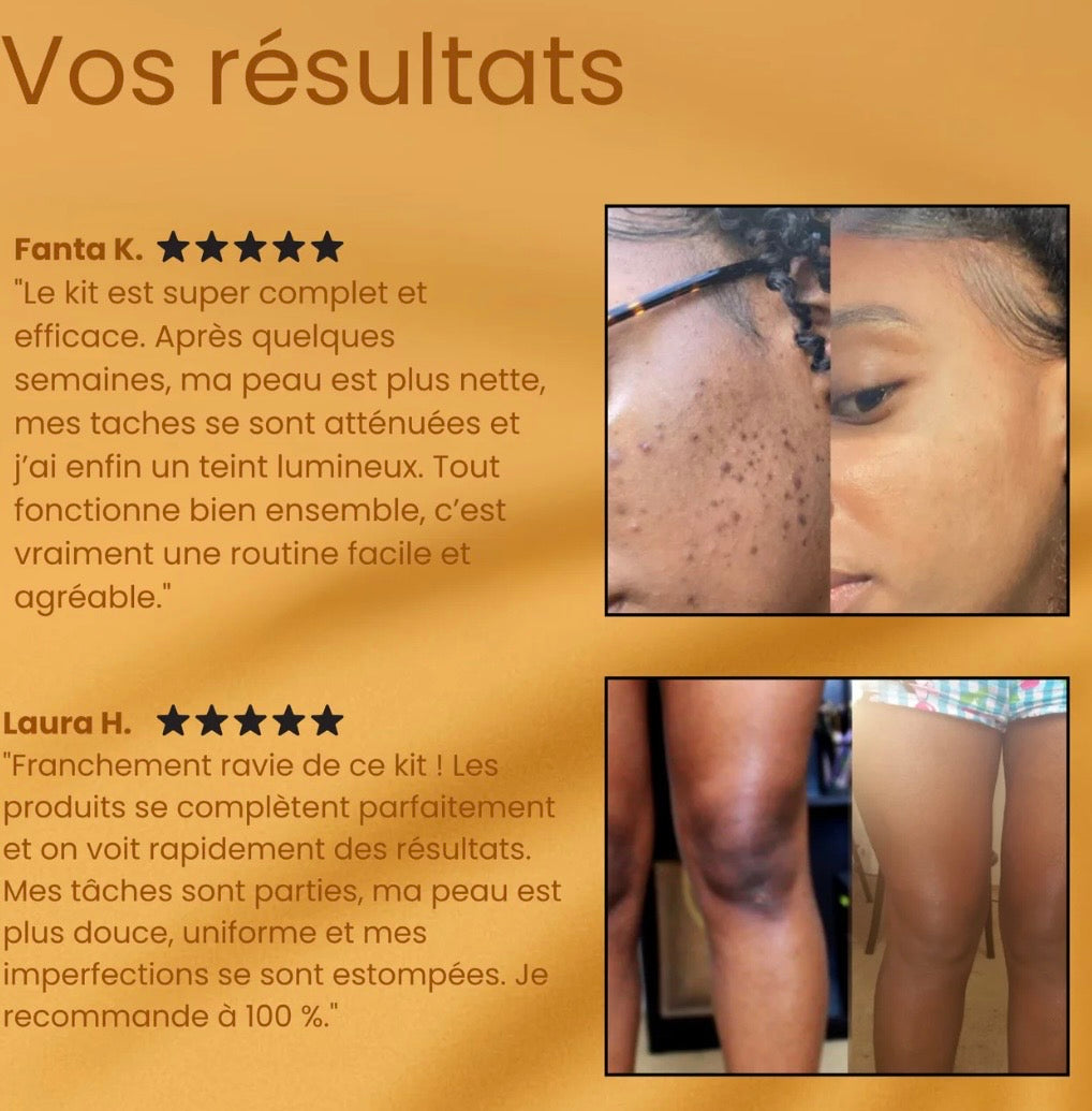 Dites adieu aux taches et au teint irrégulier