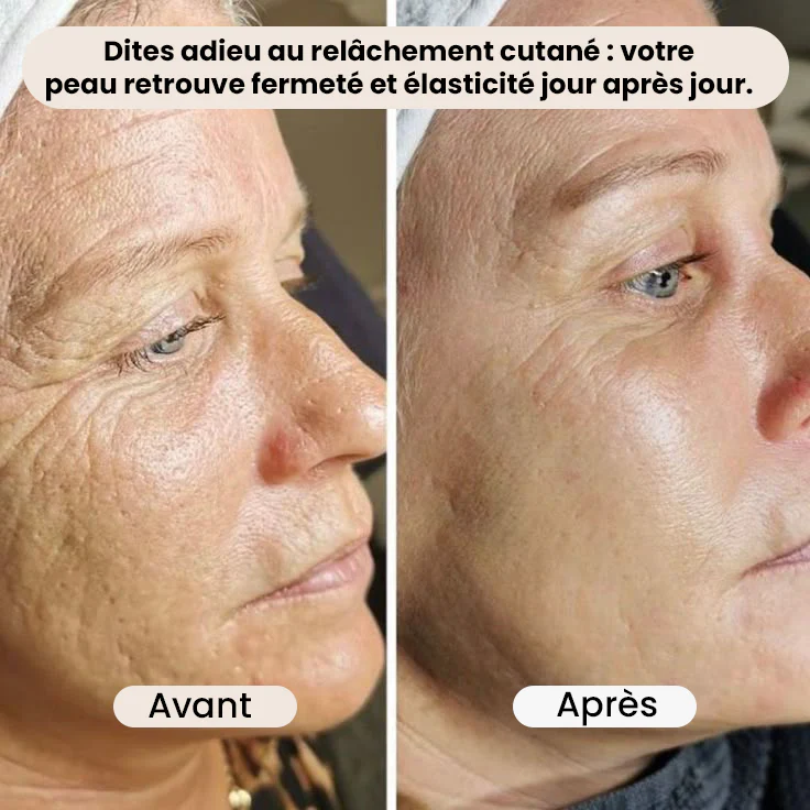 Le rituel beauté plébiscité en Europe regard reposé, peau raffermie, sans injections