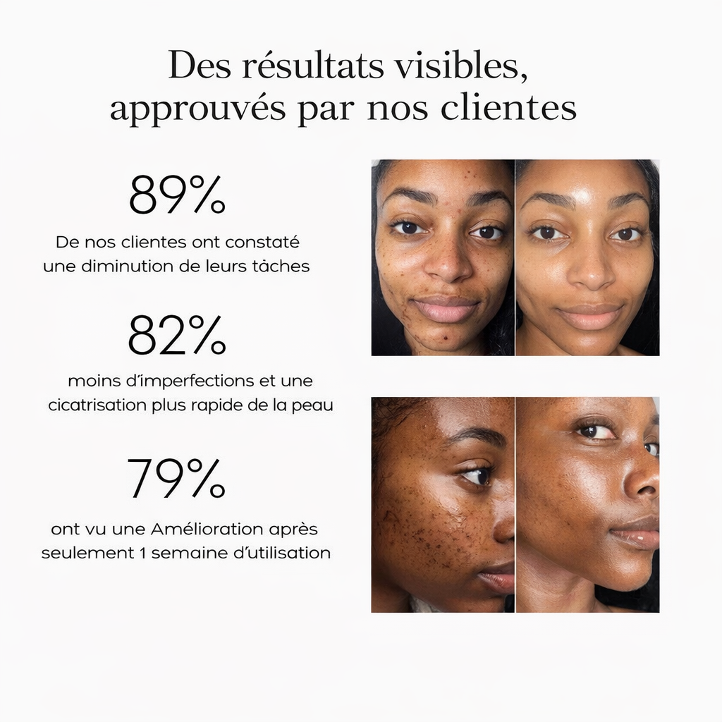 Dites adieu aux taches et au teint irrégulier