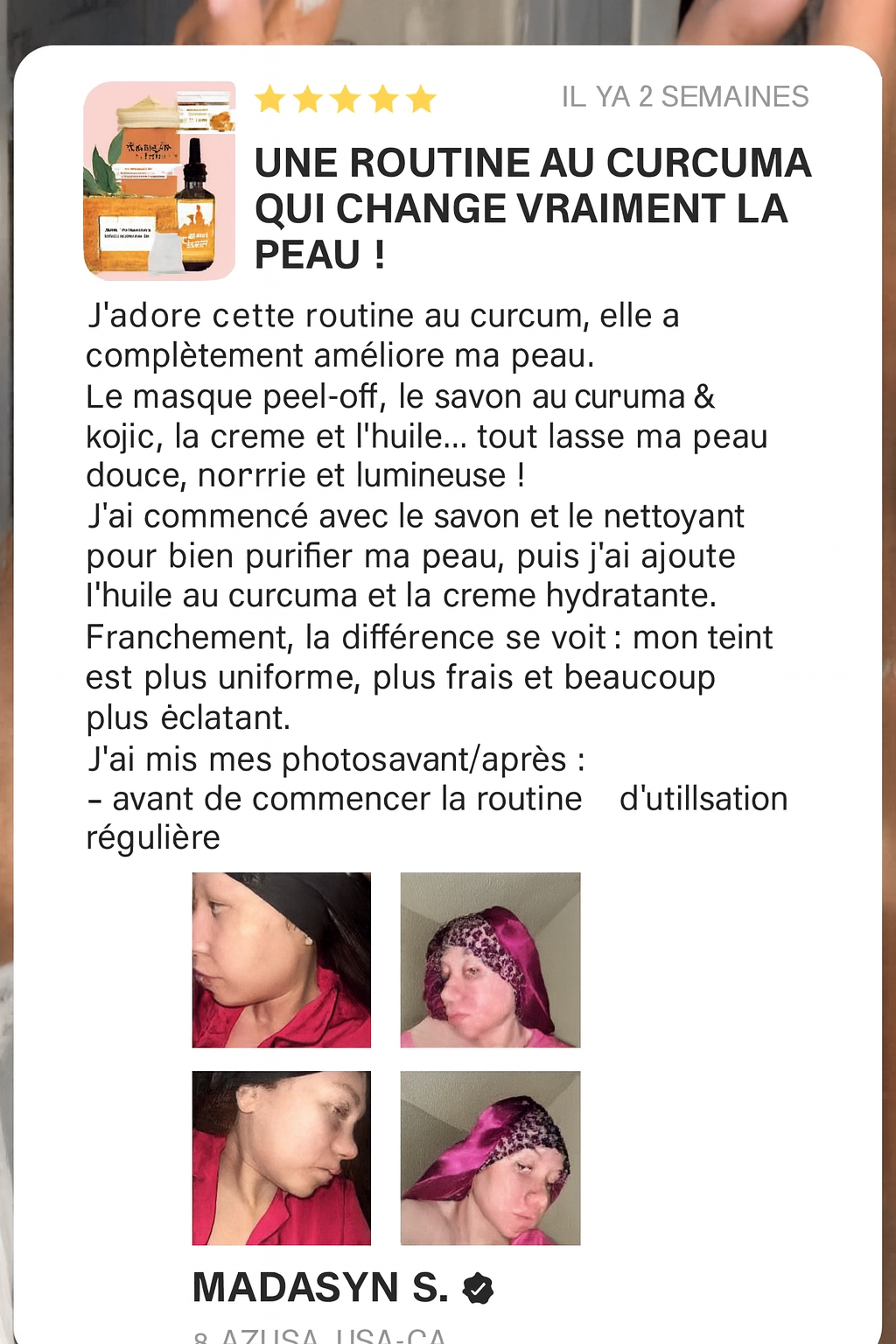 Dites adieu aux taches et au teint terne en 30 jours