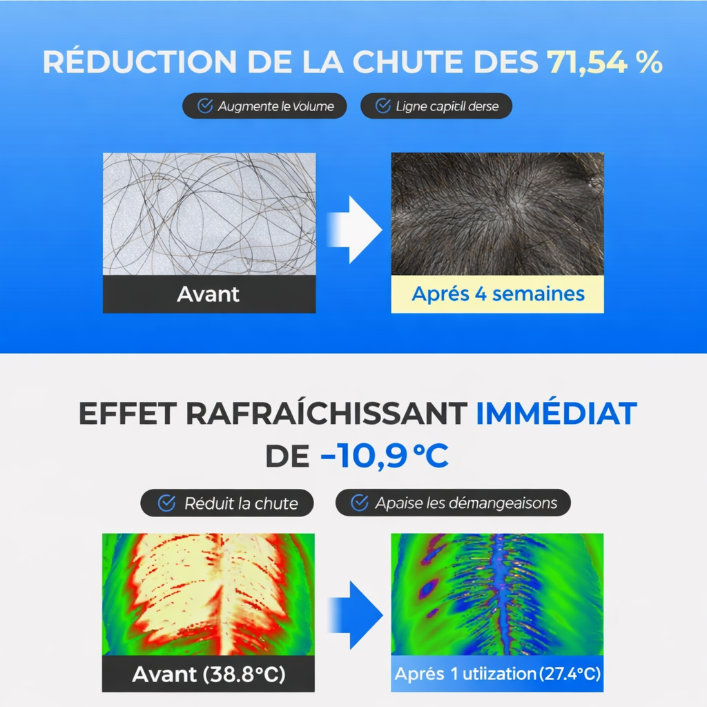 Scalpy Duo – Soin Capillaire Anti-Chute & Activation de la Repousse