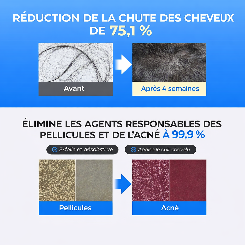 Scalpy Duo – Soin Capillaire Anti-Chute & Activation de la Repousse