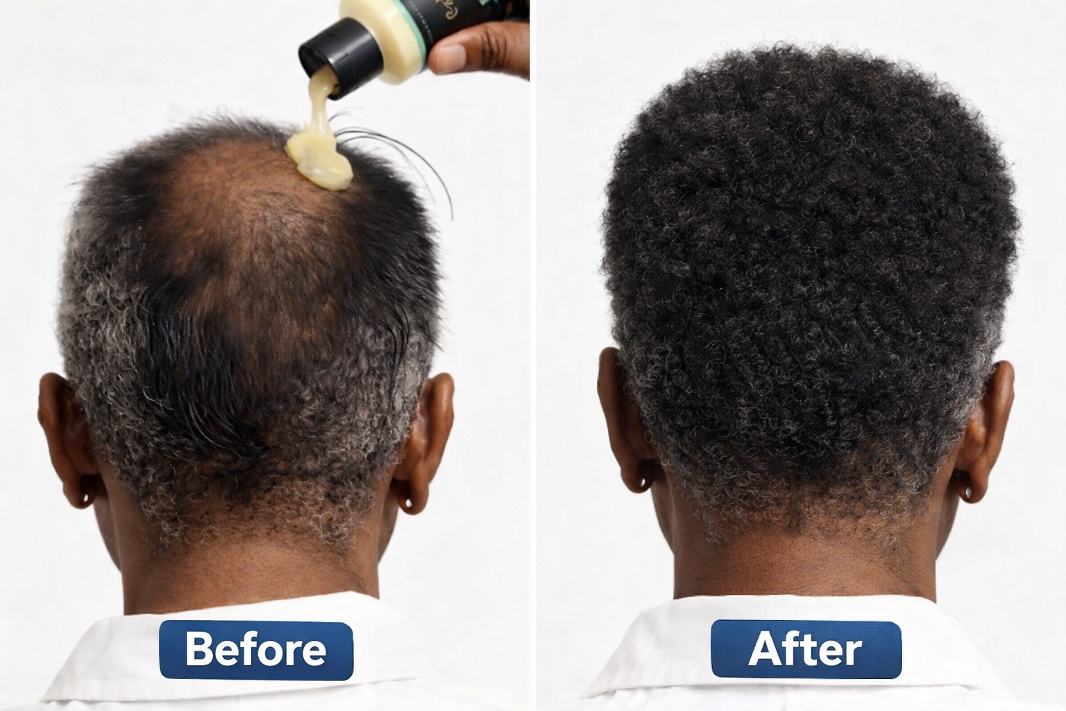 BowVibe® Seapuri® — Anti-Hair Loss, Regrowth & Hair Density