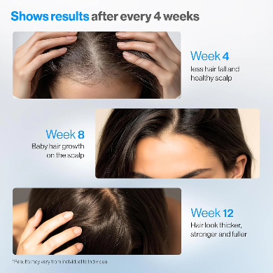 Scalpy Duo – Soin Capillaire Anti-Chute & Activation de la Repousse