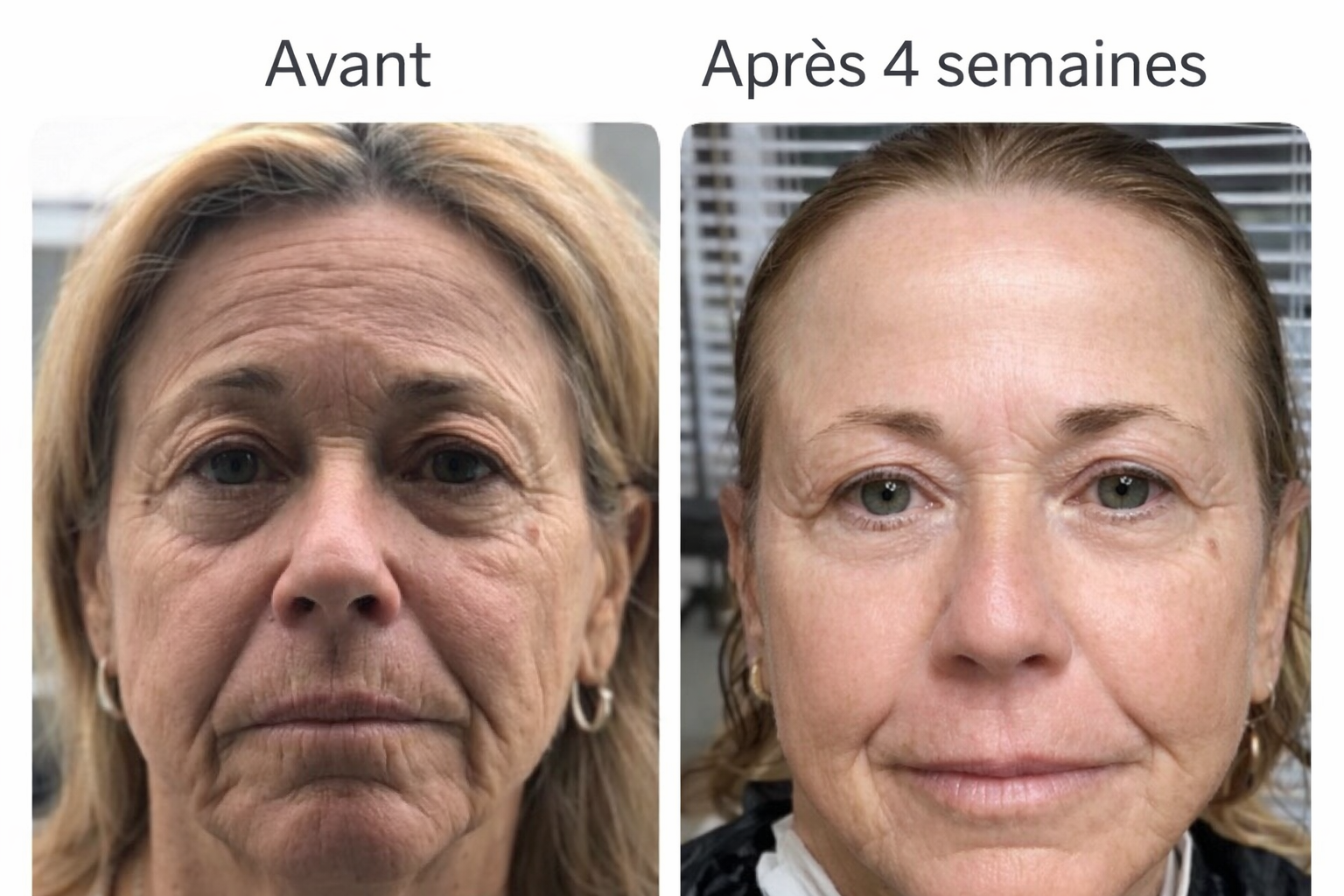 Le rituel beauté plébiscité en Europe regard reposé, peau raffermie, sans injections