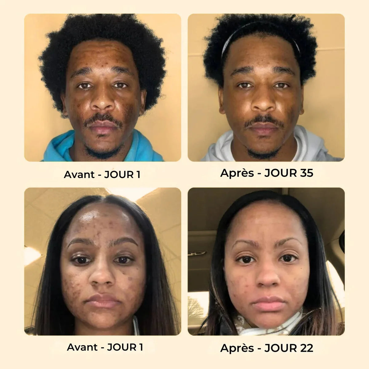 Savon Bowvibe Anti-Taches au Curcuma