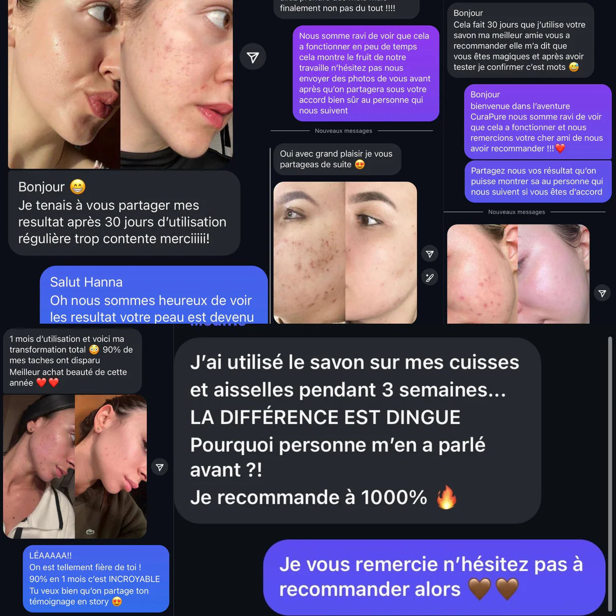 Savon Bowvibe Anti-Taches au Curcuma