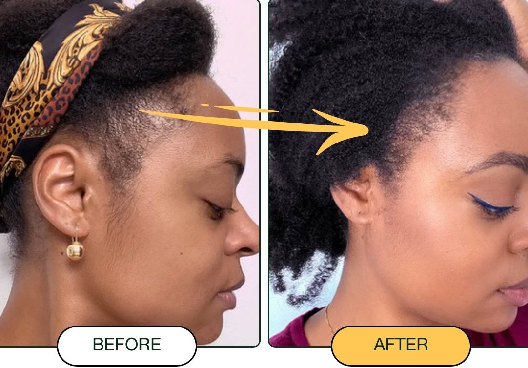 Nourishing & Fortifying Batana Oil