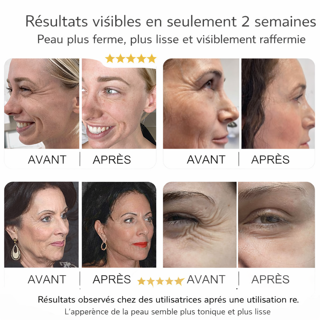 Bowvibe Correction Taches & Rides – Teint Uniforme