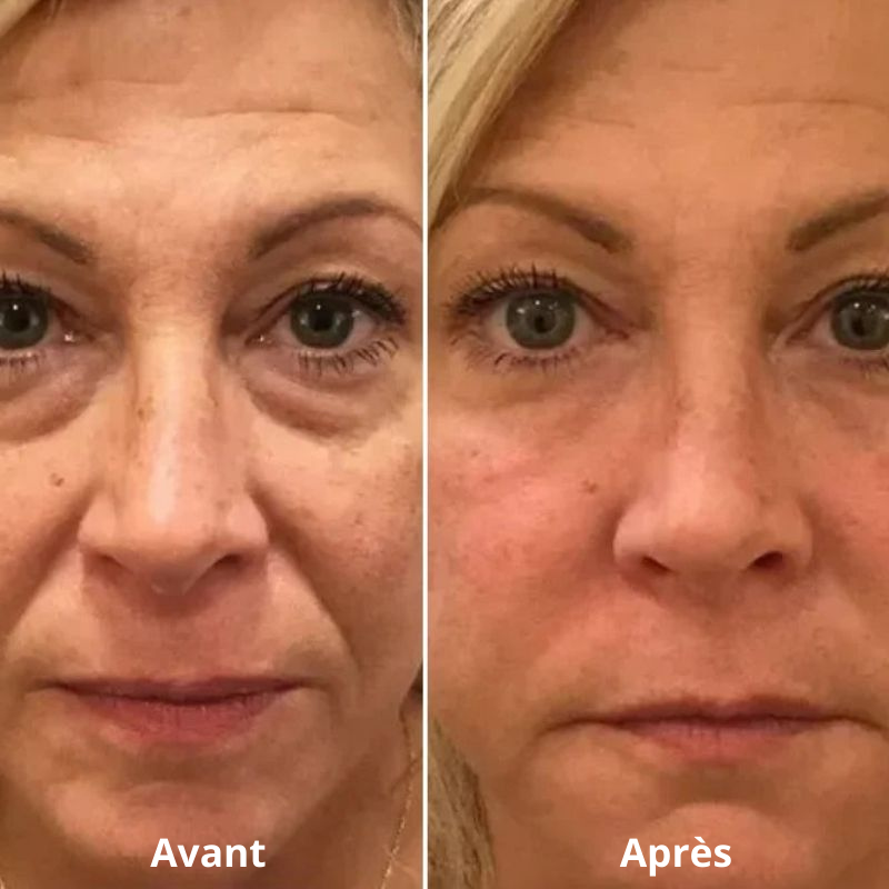 soin contour yeux anti-poches