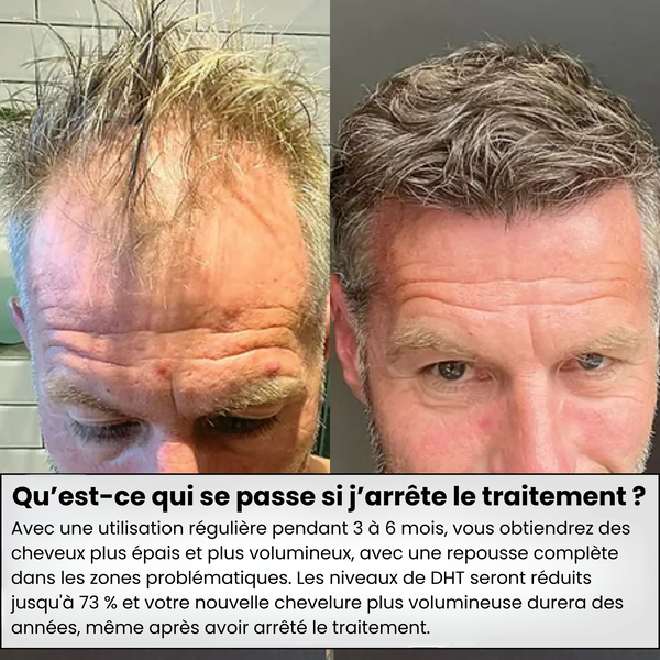 Scalpy Duo Croissance Capillaire